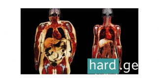 ეს დიასახლისების საყვარელი სასმელია – წონაში კლების გემრიელი და სწრაფი ხერხი