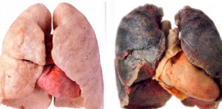 ეს სასმელი ყველა მწეველს უნდა დაალევინოთ სასწრაფოდ! გადაარჩინეთ ფილტვები!!!