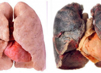 ეს სასმელი ყველა მწეველს უნდა დაალევინოთ სასწრაფოდ! გადაარჩინეთ ფილტვები!!!