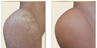 ეს საიდუმლო პედიკურის სალონებს ხურავს! – გაიჯანსაღეთ ფეხის კანი სახლში 10 წუთში და დაზოგეთ ფული