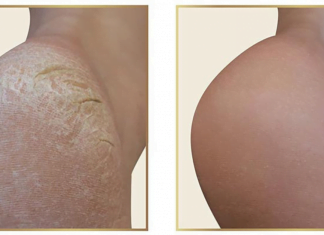 ეს საიდუმლო პედიკურის სალონებს ხურავს! – გაიჯანსაღეთ ფეხის კანი სახლში 10 წუთში და დაზოგეთ ფული