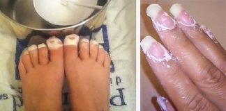 თურმე სოდით ფეხის კანის მკურნალობა შეიძლება! ეს მარტივი ხერხი პედიკურს დაგავიწყებთ