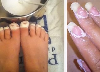 თურმე სოდით ფეხის კანის მკურნალობა შეიძლება! ეს მარტივი ხერხი პედიკურს დაგავიწყებთ