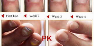 ფეხის სოკოს სამკურნალო 2 ინგრედიენტი სახლში გვქონია! – ასე სოკოს 2 დღეში მოიშორებთ