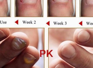 ფეხის სოკოს სამკურნალო 2 ინგრედიენტი სახლში გვქონია! – ასე სოკოს 2 დღეში მოიშორებთ