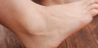 ულამაზესი ფეხები და ქუსლები! თუ წინდაში ლიმონის ქერქს ჩაიდებთ ნახეთ რა საოცრება გელით!