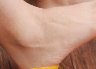 ულამაზესი ფეხები და ქუსლები! თუ წინდაში ლიმონის ქერქს ჩაიდებთ ნახეთ რა საოცრება გელით!