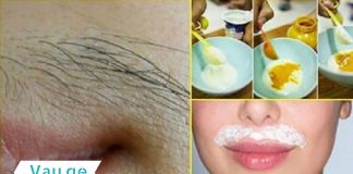 როგორ მოვიშოროთ ტუჩზედა თმა? ეს რეცეპტი ნატურალური და უსაფრთხოა…