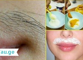 როგორ მოვიშოროთ ტუჩზედა თმა? ეს რეცეპტი ნატურალური და უსაფრთხოა…