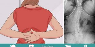 აი რატომ გტკივათ ზურგი! გაიგეთ მეტი მიზეზების და პრევენციის შესახებ!