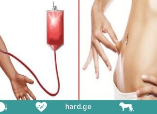 რომელი სისხლის ჯგუფი გაქვთ? ეს დიეტის დაცვაში დაგეხმარებათ!