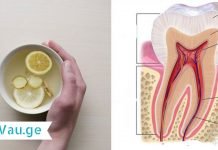 აი ამიტომ გიყვითლდებათ კბილები! ამის შემდეგ ამ ნარევს სხვა რამით ჩაანაცვლებთ!