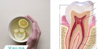 აი ამიტომ გიყვითლდებათ კბილები! ამის შემდეგ ამ ნარევს სხვა რამით ჩაანაცვლებთ!