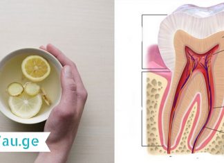 აი ამიტომ გიყვითლდებათ კბილები! ამის შემდეგ ამ ნარევს სხვა რამით ჩაანაცვლებთ!