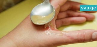 იდეალური საშუალება დამწვრობის დროს. პროდუქტი, რომელსაც ანალოგი არ აქვს