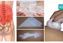 აი, რატომ უნდა გამოიყენოთ წელის ტკივილის დროს ყინული? ბევრჯერ ნაცადი ეფექტური ხერხი