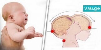 არასდროს შეარყიოთ ბავშვი! აი, რატომ იწვევს მშობლის გაუაზრებელი ქმედება ფატალურ შედეგს