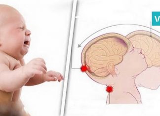 არასდროს შეარყიოთ ბავშვი! აი, რატომ იწვევს მშობლის გაუაზრებელი ქმედება ფატალურ შედეგს