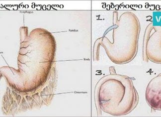 6 პროდუქტი, რომლის მიღება მუცლის შებერილობას სამუდამოდ დაგავიწყებთ