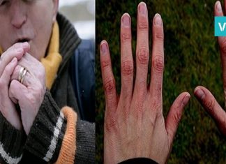 რატომ გიცივდებათ ხელები ხშირად? მიზეზები, რომლებზეც არ დაფიქრებულხართ