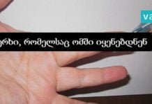 მეთოდი, რომელიც წნევას დაბლა რამდენიმე წამში წევს. ამ ხერხს ომში ხშირად იყენებდნენ