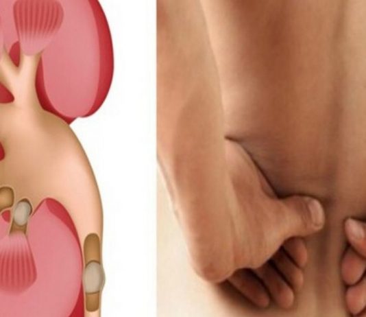 როგორ გავათავისუფლოთ თირკმელები კენჭებისგან? ყველაზე ეფექტური და სასარგებლო სიროფი