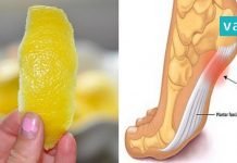 ლიმონის ქერქი სახსრების ტკივილის და ანთების წინააღმდეგ. საჭირო ინფორმაციაა