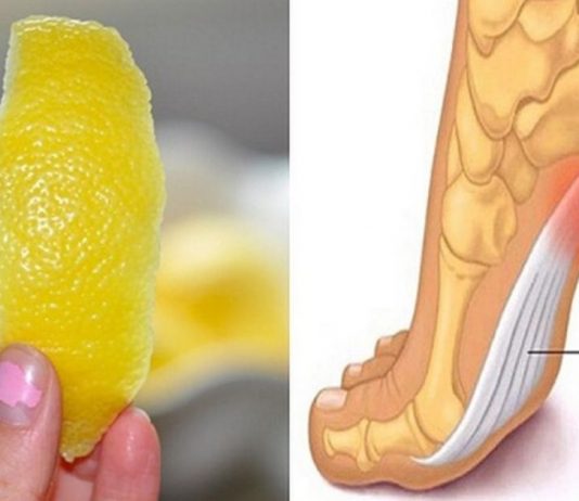 ლიმონის ქერქი სახსრების ტკივილის და ანთების წინააღმდეგ. საჭირო ინფორმაციაა