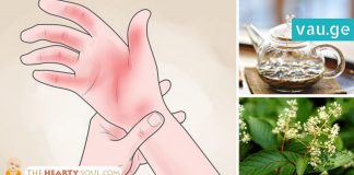 საშუალება, რომელიც რევმატოიდული ართრიტით გამოწვეულ ტკივილს აქრობს. ეფექტურია