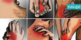 სასწაულმოქმედი რეცეპტი, რომელიც სახსრების ტკივილს 1 დღეში აქრობს! დაუჯერებელია