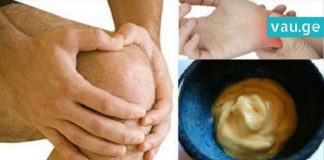 კომპრესი, რომლის დახმარებით სახსრების ტკივილი 1 ღამეში გაქრება. მარტივი და ეფექტურია