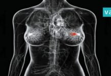 მკერდის კიბოს გამომწვევი ორი ყველაზე შემაშფოთებელი მიზეზი… თქვენ ეს უნდ იცოდეთ!