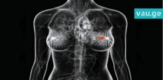 მკერდის კიბოს გამომწვევი ორი ყველაზე შემაშფოთებელი მიზეზი… თქვენ ეს უნდ იცოდეთ!