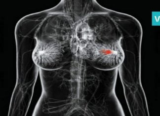 მკერდის კიბოს გამომწვევი ორი ყველაზე შემაშფოთებელი მიზეზი… თქვენ ეს უნდ იცოდეთ!