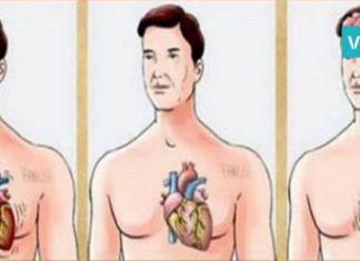 როგორ განვასხვაოთ ერთმანეთისგან ინსულტი, ინფარქტი და გულის გაჩერება?