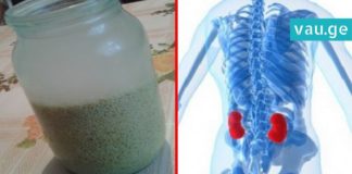 როგორ გამოვდევნოთ თირკმელებიდან კენჭები 15 დღეში? ეს საოცარი მასალა დაგეხმარებათ ამაში!