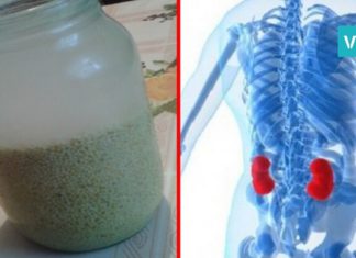 როგორ გამოვდევნოთ თირკმელებიდან კენჭები 15 დღეში? ეს საოცარი მასალა დაგეხმარებათ ამაში!