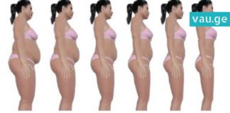 როგორ შევამციროთ ორგანიზმში შაქრის დოზა? ეს რჩევები მარტივად გახდომაში დაგეხმარებათ !