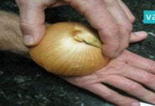 ჯანმრთელობასთან დაკავშირებული 5 პრობლემა, რომელსაც ხახვის დახმარებით გადაჭრით