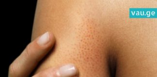 8 ნიშანი იმისა, რომ პურის ჭამა უნდა აკრძალოთ… აუცილებლად წასაკითხი სტატიაა!