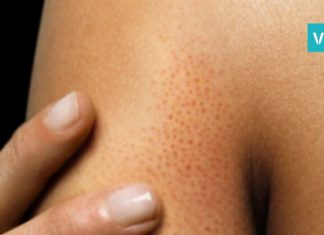 8 ნიშანი იმისა, რომ პურის ჭამა უნდა აკრძალოთ… აუცილებლად წასაკითხი სტატიაა!