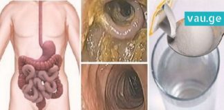 მეთოდი, რომელიც ორგანიზმს ცხიმებისა და ტოქსინებისგან წმენდს. საუკეთესო საშუალებაა