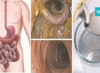 მეთოდი, რომელიც ორგანიზმს ცხიმებისა და ტოქსინებისგან წმენდს. საუკეთესო საშუალებაა