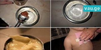 ხველის საწინააღმდეგო ეფექტური კომპრესი, რომლისთვისაც მხოლოდ ეს 2 ინგრედიენტია საჭირო