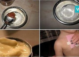 ხველის საწინააღმდეგო ეფექტური კომპრესი, რომლისთვისაც მხოლოდ ეს 2 ინგრედიენტია საჭირო