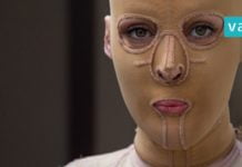 ის თავდასხმის მსხვერპლი გახდა. 2 წლის შემდეგ კი, მან ნიღაბი მოიხსნა და… მოულოდნელია!