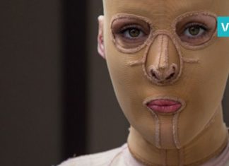 ის თავდასხმის მსხვერპლი გახდა. 2 წლის შემდეგ კი, მან ნიღაბი მოიხსნა და… მოულოდნელია!