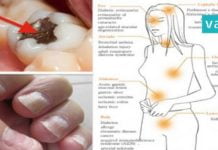 ეს სასიკვდილო შხამი თქვენს ორგანიზმშია! რა უნდა ვიცოდეთ მის შესახებ? ყურადსაღებია