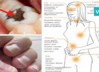 ეს სასიკვდილო შხამი თქვენს ორგანიზმშია! რა უნდა ვიცოდეთ მის შესახებ? ყურადსაღებია