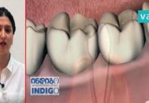 როგორ გავაქროთ უსიამოვნო სუნი პირის ღრუდან. რჩევა რომელიც ყველას გჭირდებათ!